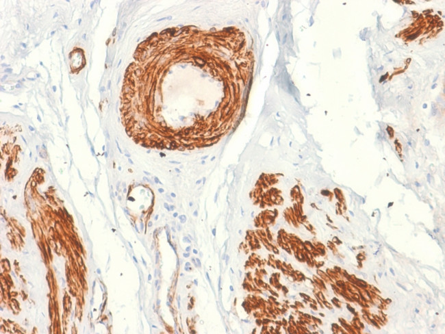 Caldesmon, HMW (h-Caldesmon) Antibody in Immunohistochemistry (Paraffin) (IHC (P))