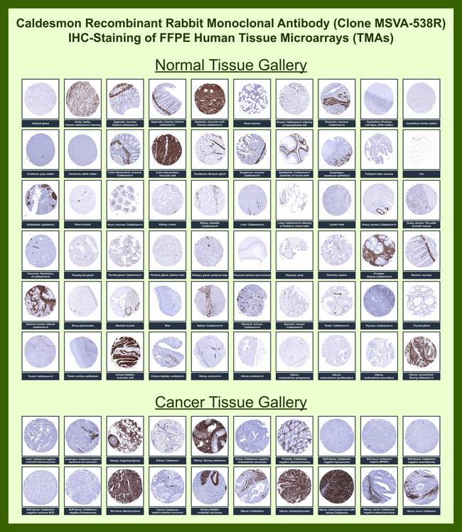 Caldesmon, HMW (h-Caldesmon) (Smooth Muscle Marker) Antibody in Immunohistochemistry (Paraffin) (IHC (P))