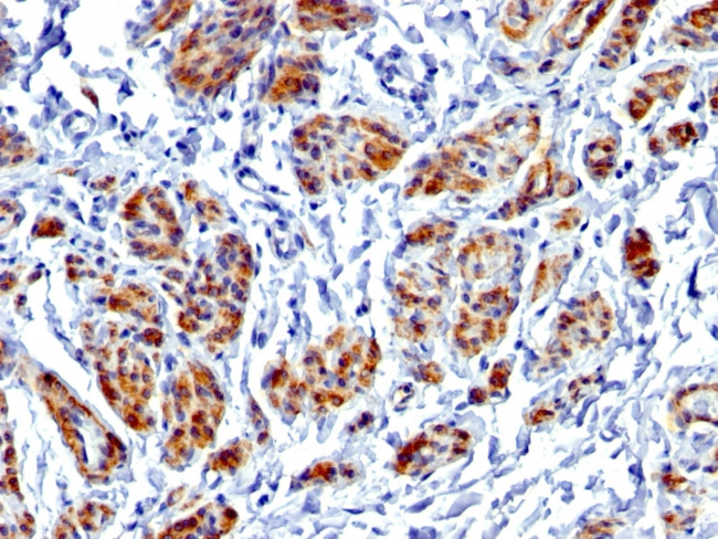 Caldesmon, HMW (h-Caldesmon) Antibody in Immunohistochemistry (Paraffin) (IHC (P))