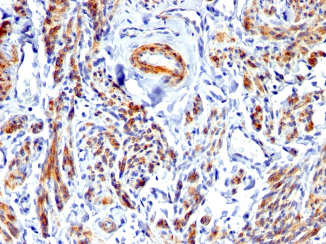 Caldesmon, HMW (h-Caldesmon) (Smooth Muscle Marker) Antibody in Immunohistochemistry (Paraffin) (IHC (P))