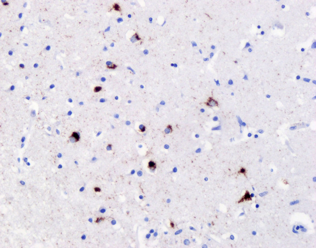 Phospho-TDP43 (Ser409, Ser410) Antibody in Immunohistochemistry (IHC)