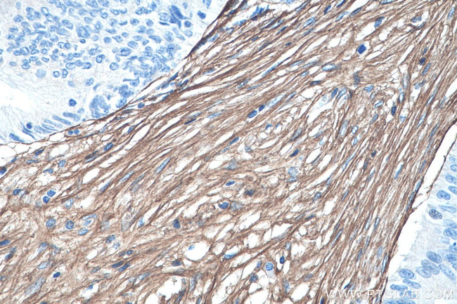 Collagen Type III Antibody in Immunohistochemistry (Paraffin) (IHC (P))