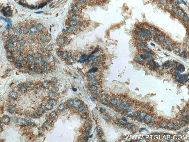 IkB Alpha Antibody in Immunohistochemistry (Paraffin) (IHC (P))
