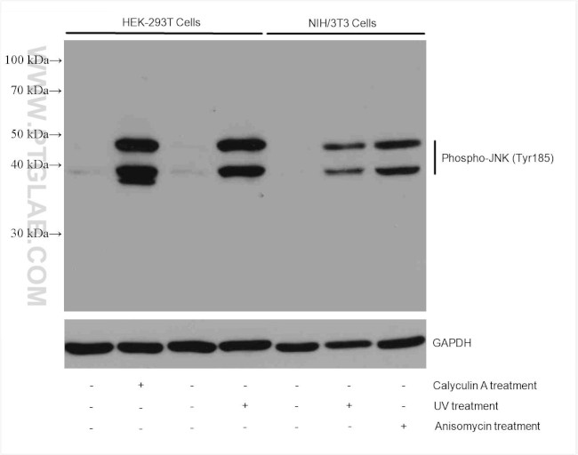 Phospho-JNK (Tyr185) Antibody in Western Blot (WB)