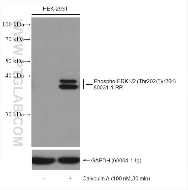 Phospho-ERK1/2 (Thr202, Tyr204) Antibody in Western Blot (WB)