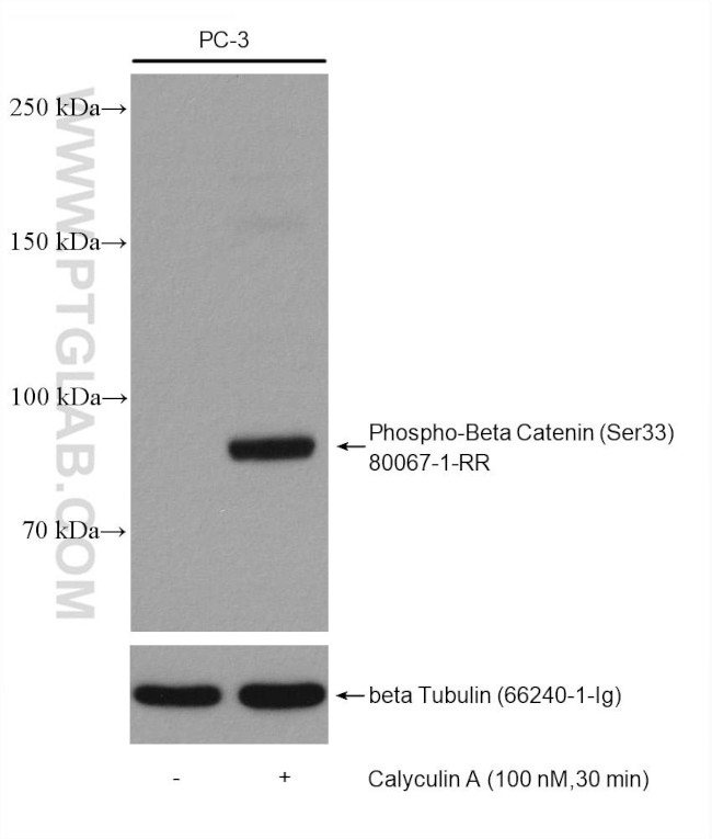 Phospho-Beta Catenin (Ser33) Antibody in Western Blot (WB)