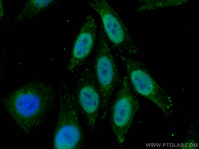 P53 Antibody in Immunocytochemistry (ICC/IF)