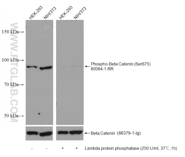 Phospho-Beta Catenin (Ser675) Antibody in Western Blot (WB)