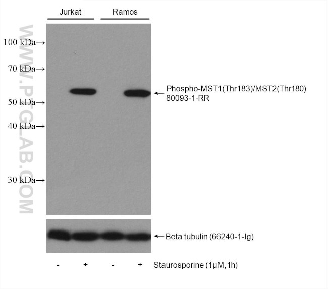 Phospho-MST1/MST2 (Thr183, Thr180) Antibody in Western Blot (WB)