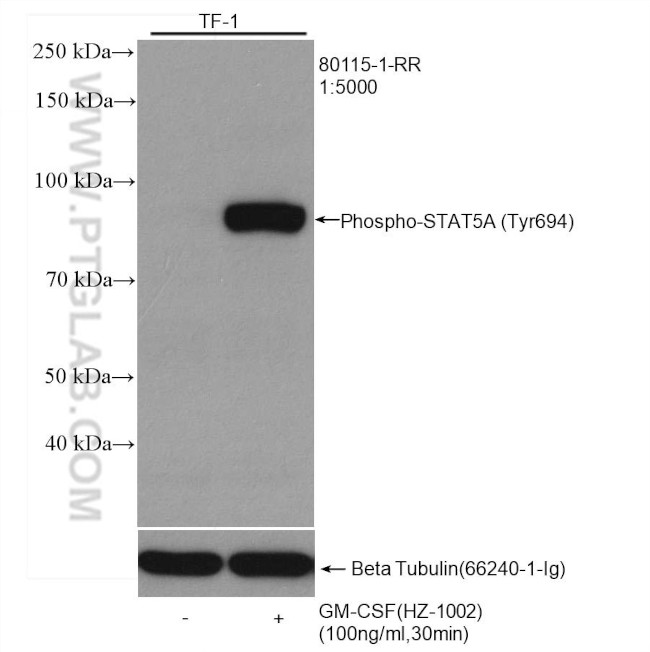 Phospho-STAT5A (Tyr694) Antibody in Western Blot (WB)