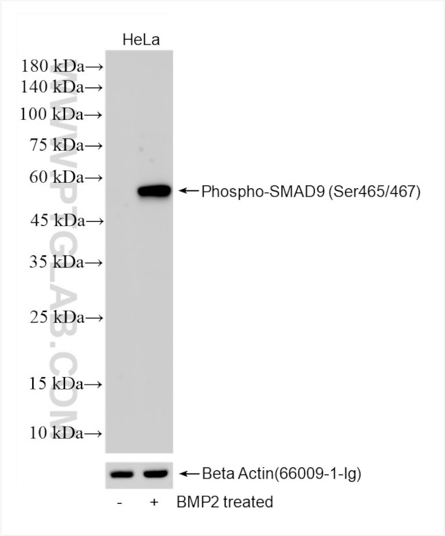 Phospho-SMAD9 (Ser465, Ser467) Antibody in Western Blot (WB)