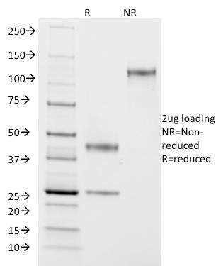 ASRGL1 (Asparaginase Like 1) Antibody in SDS-PAGE (SDS-PAGE)