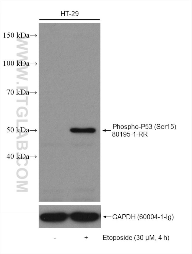 Phospho-P53 (Ser15) Antibody in Western Blot (WB)
