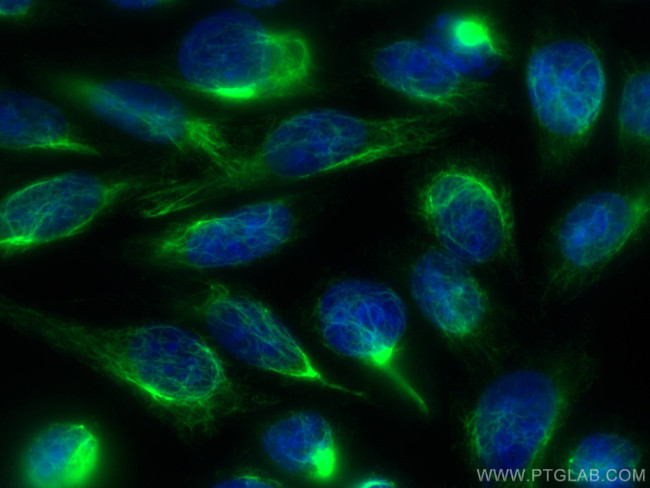 Vimentin Antibody in Immunocytochemistry (ICC/IF)