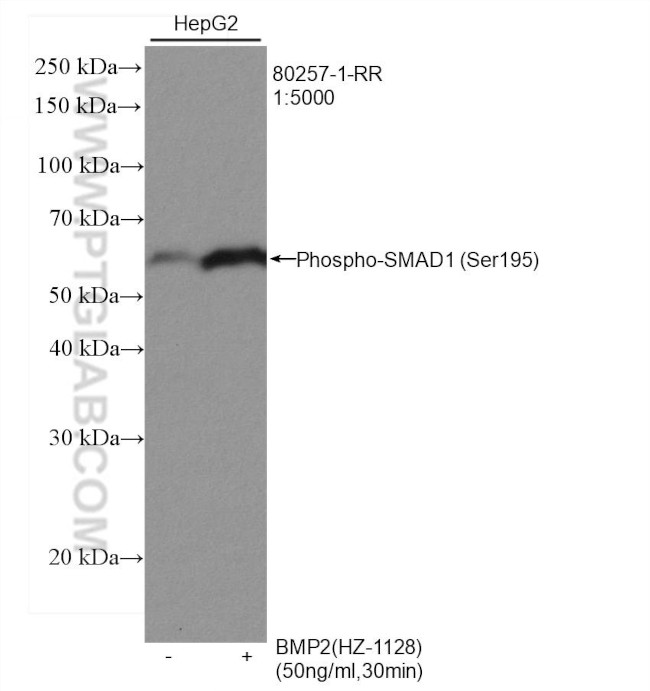 Phospho-SMAD1 (Ser195) Antibody in Western Blot (WB)