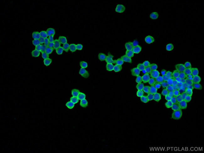 CD45 Antibody in Immunocytochemistry (ICC/IF)