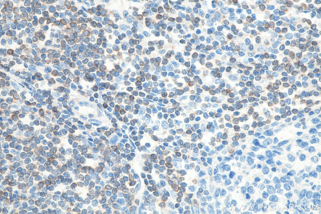 BCL2 Antibody in Immunohistochemistry (Paraffin) (IHC (P))