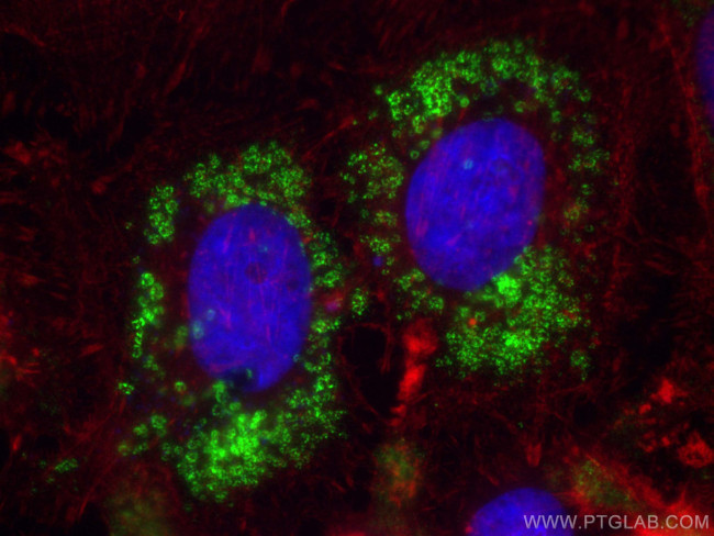 Perilipin-2 Antibody in Immunocytochemistry (ICC/IF)
