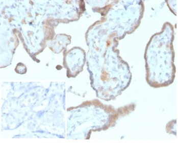 CD276/B7-H3 Antibody in Immunohistochemistry (Paraffin) (IHC (P))