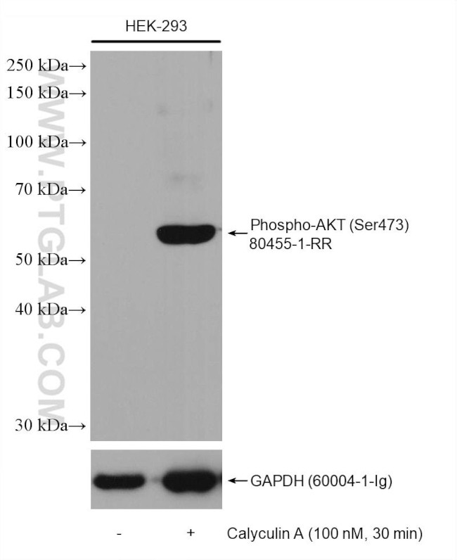 Phospho-AKT (Ser473) Antibody in Western Blot (WB)