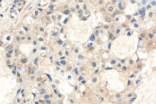 AKT1 Antibody in Immunohistochemistry (Paraffin) (IHC (P))