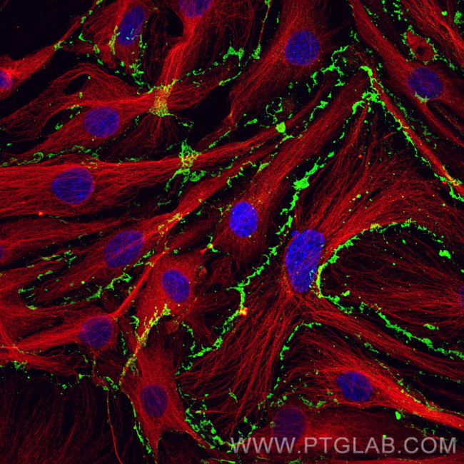 CD31 Antibody in Immunocytochemistry (ICC/IF)