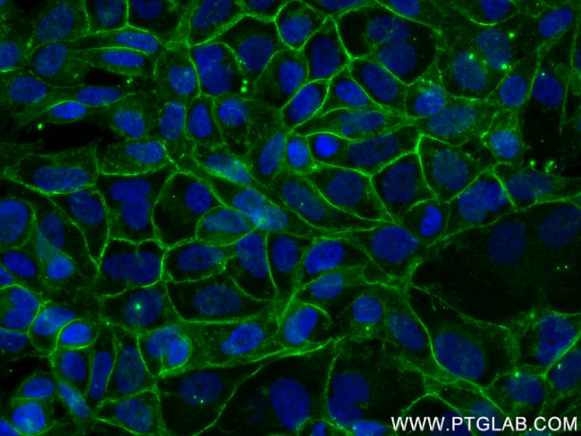 E-cadherin Antibody in Immunocytochemistry (ICC/IF)