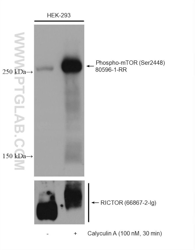 Phospho-mTOR (Ser2448) Antibody in Western Blot (WB)