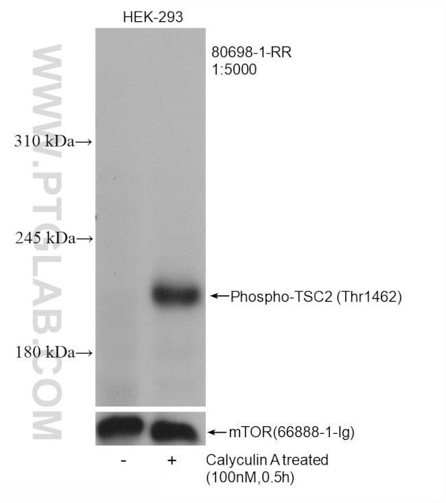 Phospho-TSC2 (Thr1462) Antibody in Western Blot (WB)