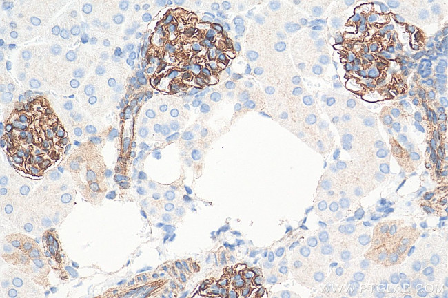 SYNPO Antibody in Immunohistochemistry (Paraffin) (IHC (P))