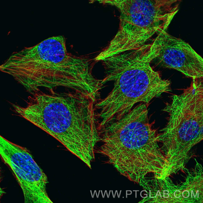 Alpha Tubulin Antibody in Immunocytochemistry (ICC/IF)