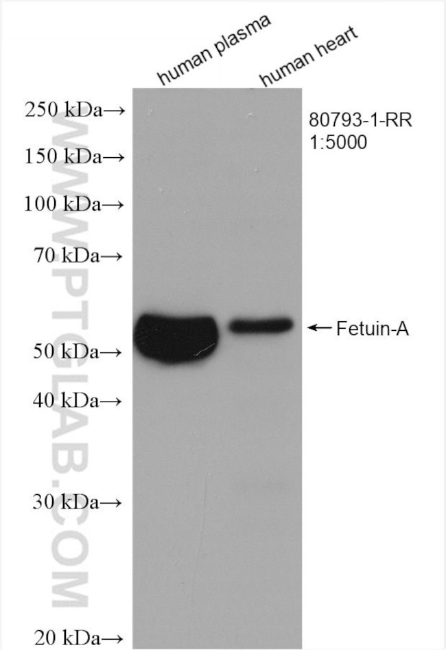 Fetuin-A Antibody in Western Blot (WB)
