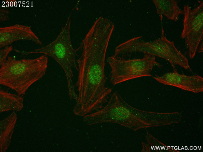 p38 MAPK Antibody in Immunocytochemistry (ICC/IF)