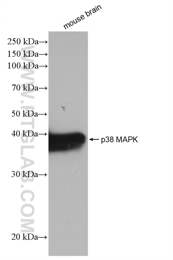 p38 MAPK Antibody in Western Blot (WB)