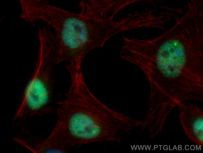 MYC Antibody in Immunocytochemistry (ICC/IF)
