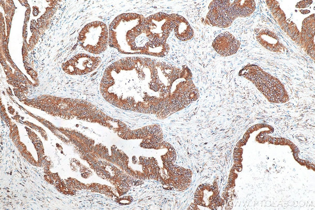 GRP78, BIP Antibody in Immunohistochemistry (Paraffin) (IHC (P))