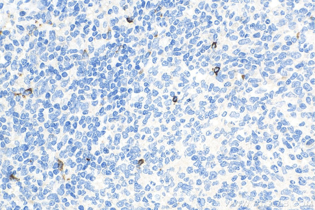 LAG3 Antibody in Immunohistochemistry (Paraffin) (IHC (P))