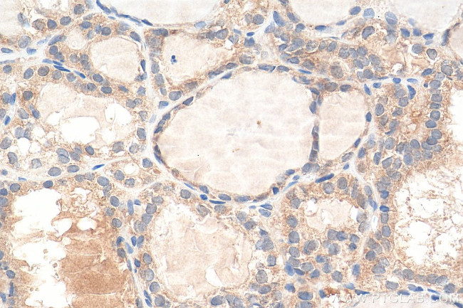 HIF-1 alpha Antibody in Immunohistochemistry (Paraffin) (IHC (P))