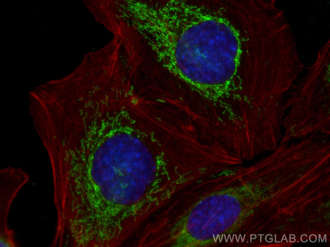 OXCT1 Antibody in Immunocytochemistry (ICC/IF)
