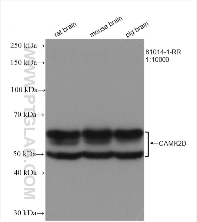 CAMK2D Antibody in Western Blot (WB)