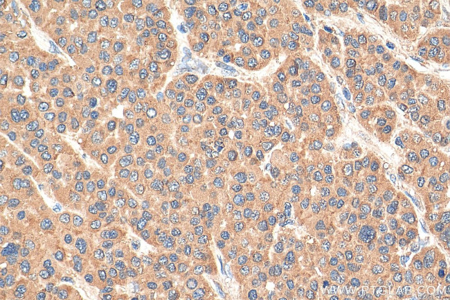 DHFR Antibody in Immunohistochemistry (Paraffin) (IHC (P))