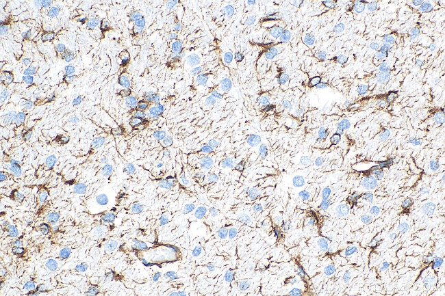 GFAP Antibody in Immunohistochemistry (Paraffin) (IHC (P))