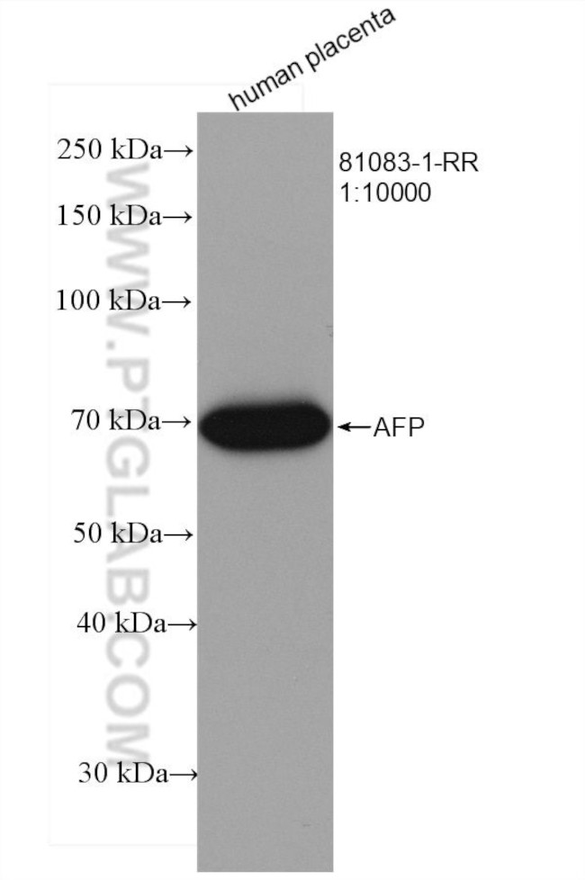 AFP Antibody in Western Blot (WB)