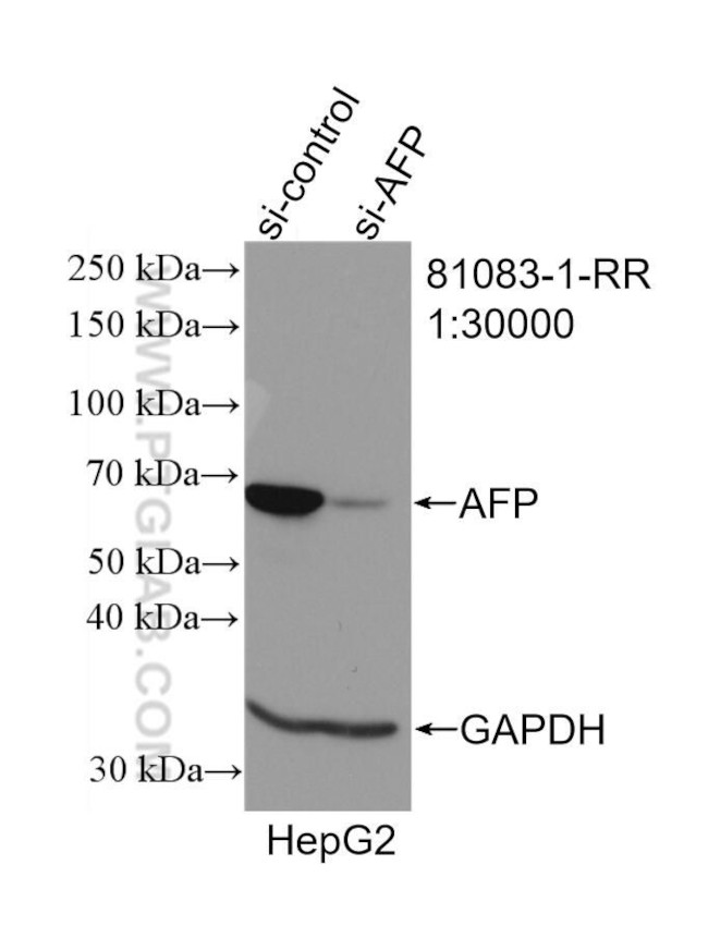 Afp Wb AFP Recombinant Monoclonal Antibody (2D17) (81083-1-RR100UL)