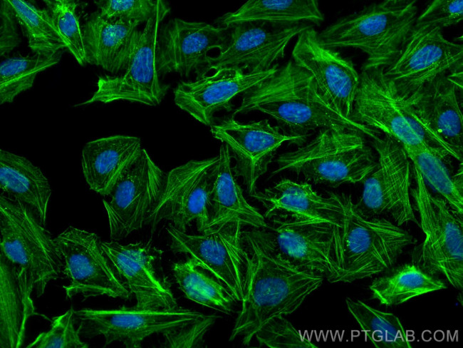 Beta Actin Antibody in Immunocytochemistry (ICC/IF)
