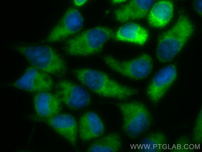 GRB10 Antibody in Immunocytochemistry (ICC/IF)