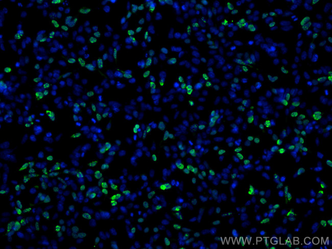HA Tag Antibody in Immunocytochemistry (ICC/IF)