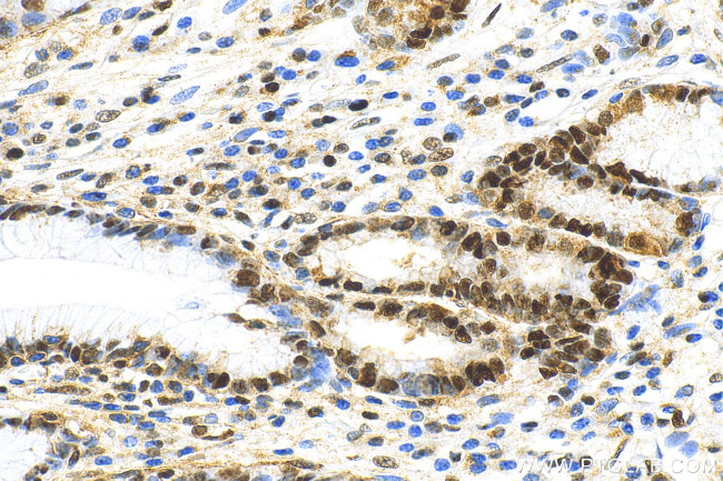 PCNA Antibody in Immunohistochemistry (Paraffin) (IHC (P))