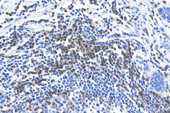 CD3 Antibody in Immunohistochemistry (Paraffin) (IHC (P))