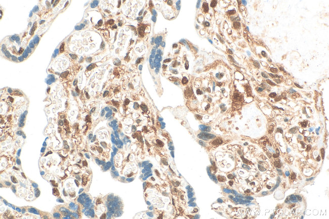 PPAR Gamma Antibody in Immunohistochemistry (Paraffin) (IHC (P))